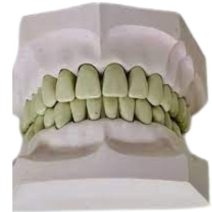 Modelo de yeso con dientes de ivorina Dyma® referencia: Y-200